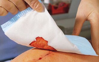 Bandage required after penis enlargement surgery
