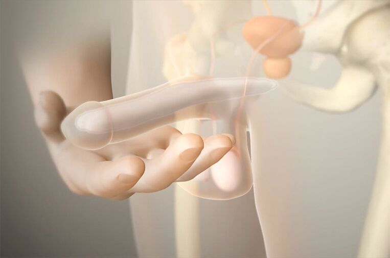 Gel implants add members