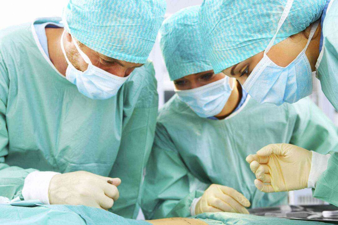 Penis Enlargement Surgery and Its Price Photo 3
