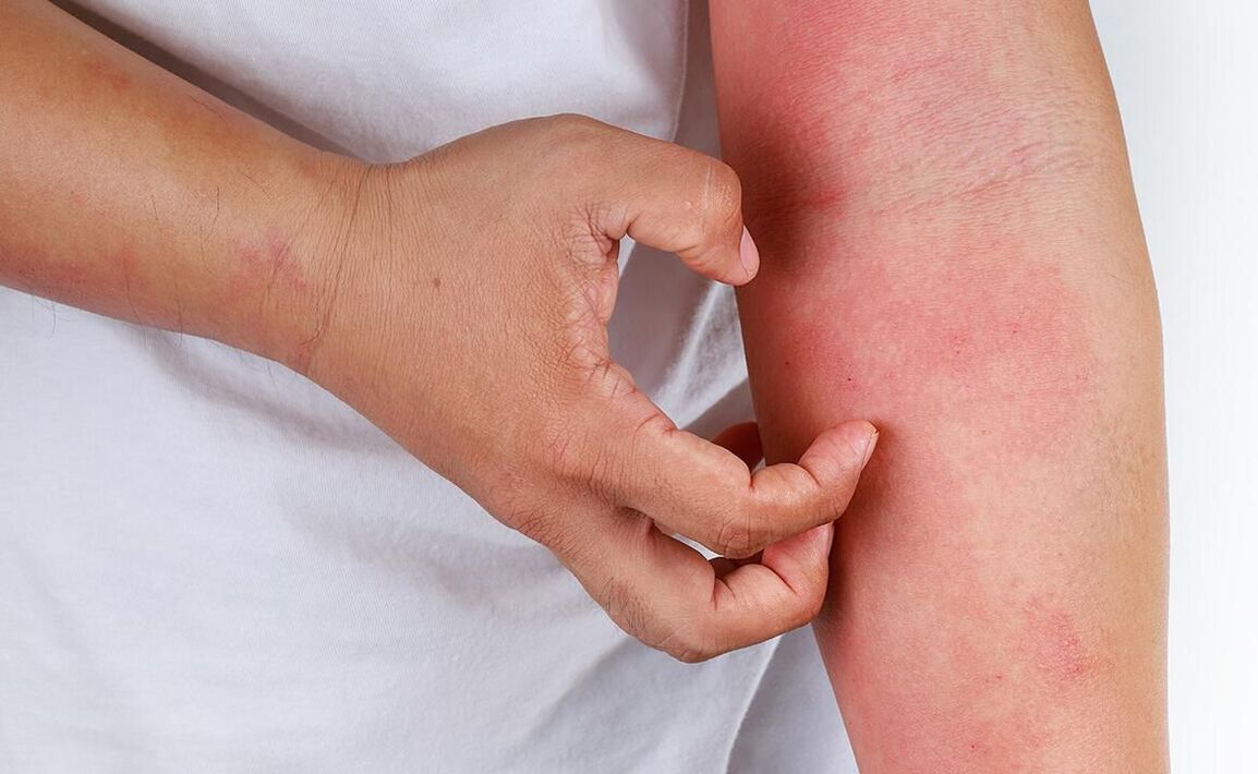 Possible complications of using soda