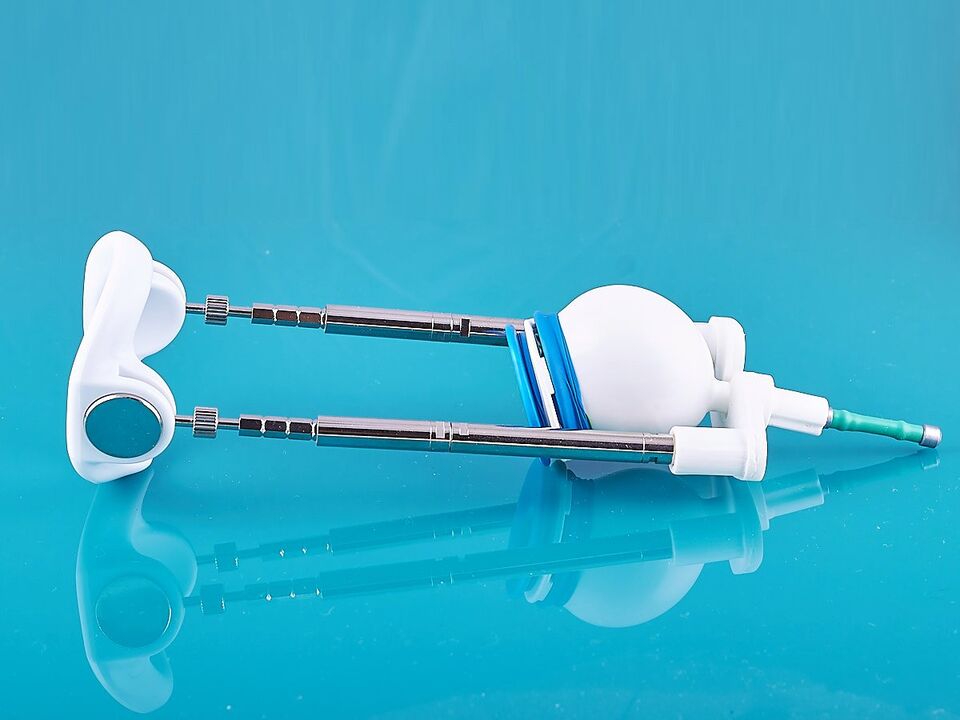 Extenders will help improve the results of ligament surgery